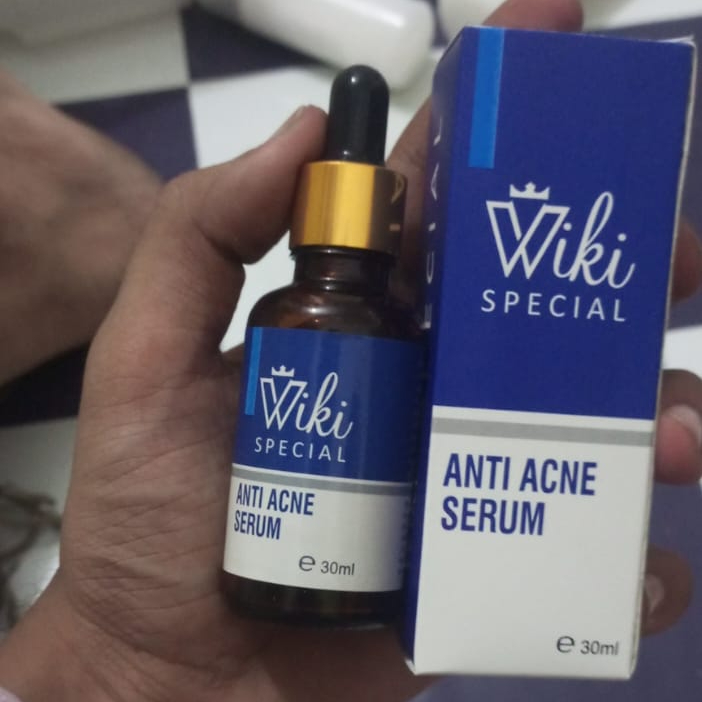 Viki Special Anti Acne Serum – 30ml | Deep Pore Cleansing & Blemish Control Formula for Clearer Skin - Image 2